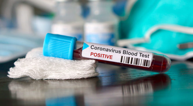 Оперативна інформація про поширення коронавірусної інфекції COVID-19 станом на 20.03.2020