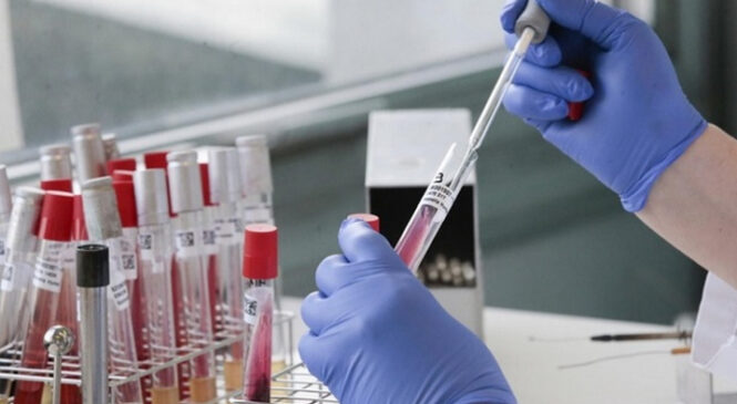 За тиждень на COVID-19 занедужали 1237 буковинців