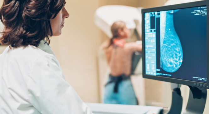 У медзакладах Чернівців можна безкоштовно зробити мамографію